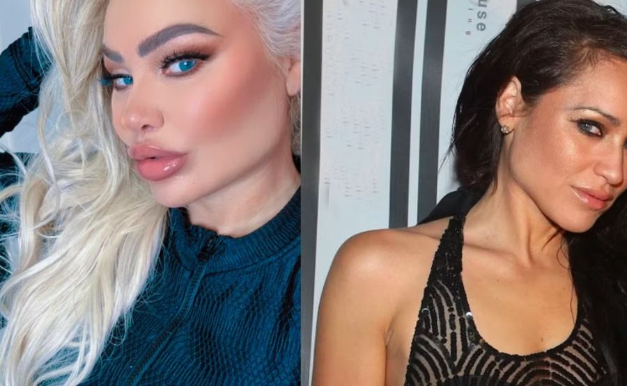 Darcy and Stacy Before Surgery: What Changed Over the Years? 